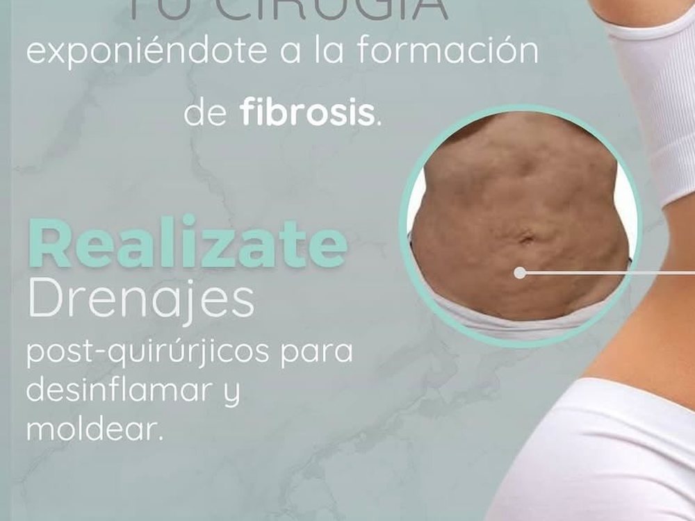 Manejo de Fibrosis